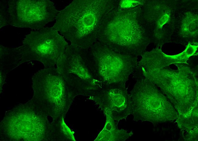 Recombinant UCHL1/PGP9.5 Monoclonal Antibody - small - 1