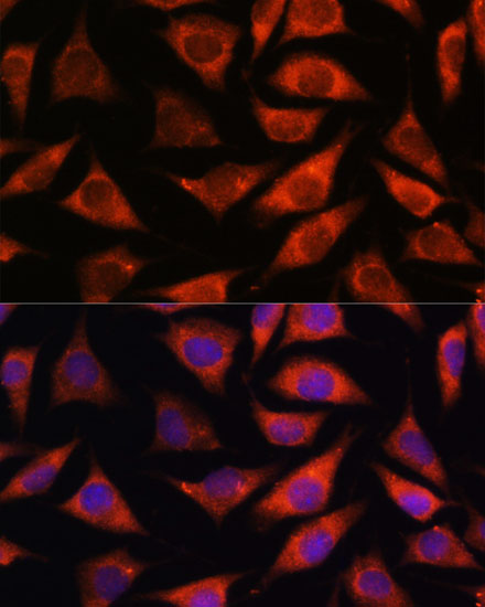 Immunofluorescence analysis of L929 cells using TMX2 Polyclonal Antibody at dilution of  1:100. Blue: DAPI for nuclear staining.