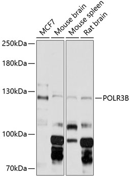 Western blot analysis of extracts of various cell lines using POLR3B Polyclonal Antibody at 1:3000 dilution.