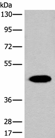 Western blot analysis of Human liver tissue lysate  using FAH Polyclonal Antibody at dilution of 1:700