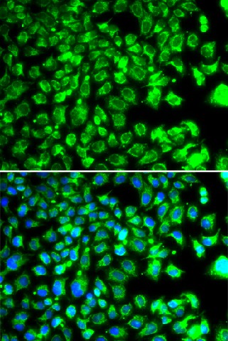 Immunofluorescence analysis of MCF-7 cells using C10orf32 Polyclonal Antibody