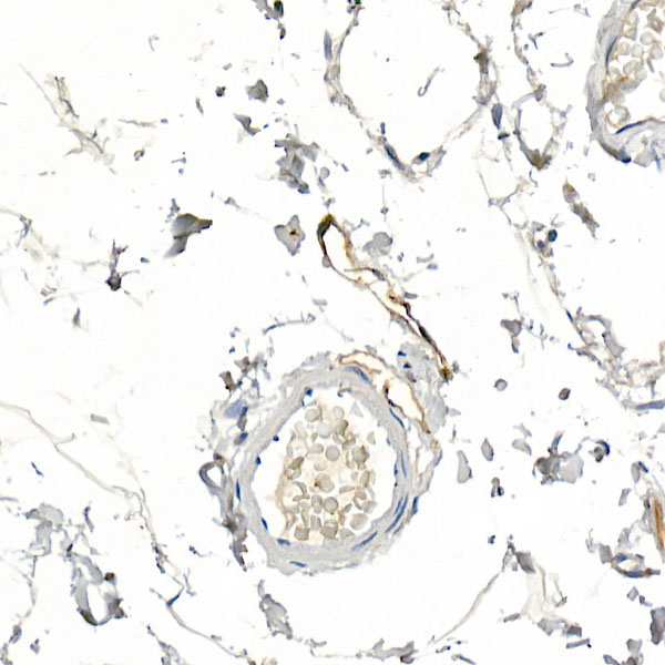 Immunohistochemistry of paraffin-embedded human colon using Podoplanin Polyclonal Antibody at dilution of 1:20 (40x lens).Perform high pressure antigen retrieval with 10 mM citrate buffer pH 6.0 before commencing with IHC staining protocol.