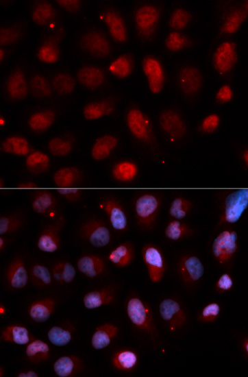 Immunofluorescence analysis of U2OS cells using Pea3 / ETV4 Polyclonal Antibody