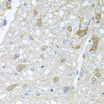 Immunohistochemistry of paraffin-embedded Rat brain using RAPSN Polyclonal Antibody at dilution of 1:100 (40x lens).