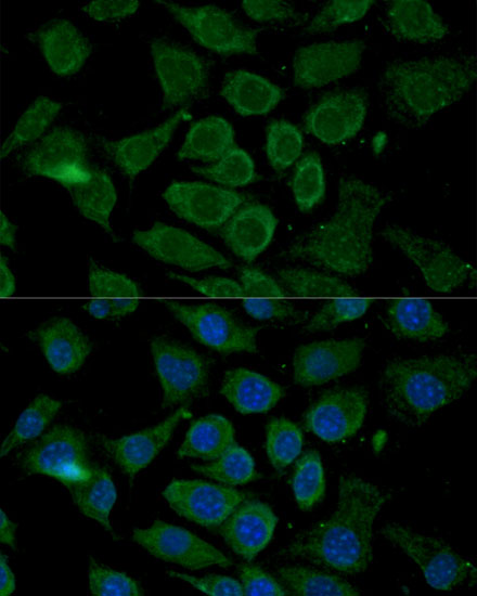 Immunofluorescence analysis of L929 cells using Bcl-2 Polyclonal Antibody at dilution of 1:100. Blue: DAPI for nuclear staining.