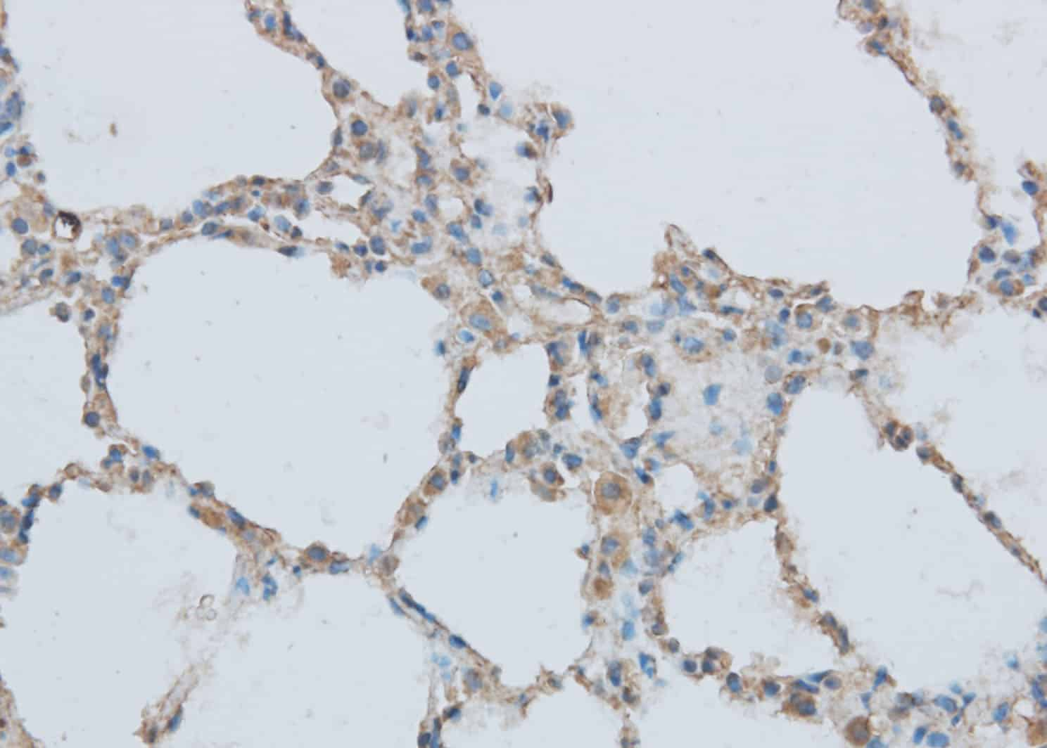 Immunohistochemistry of paraffin-embedded Rat lung using MMP1 Polyclonal Antibody at dilution of 1:50