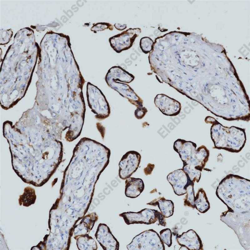 HCG Monoclonal Antibody - 1