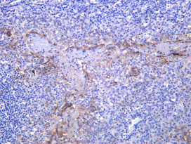Recombinant CHI3L1 Monoclonal Antibody - 1