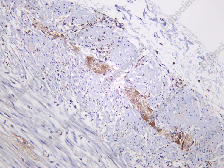 Recombinant PDK4 Monoclonal Antibody - 1