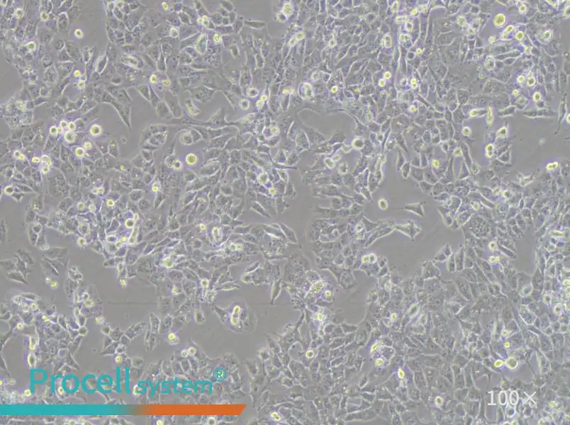NCI-H1915 Cell Complete MediumNCI-H1915 Cell Complete Medium - 3