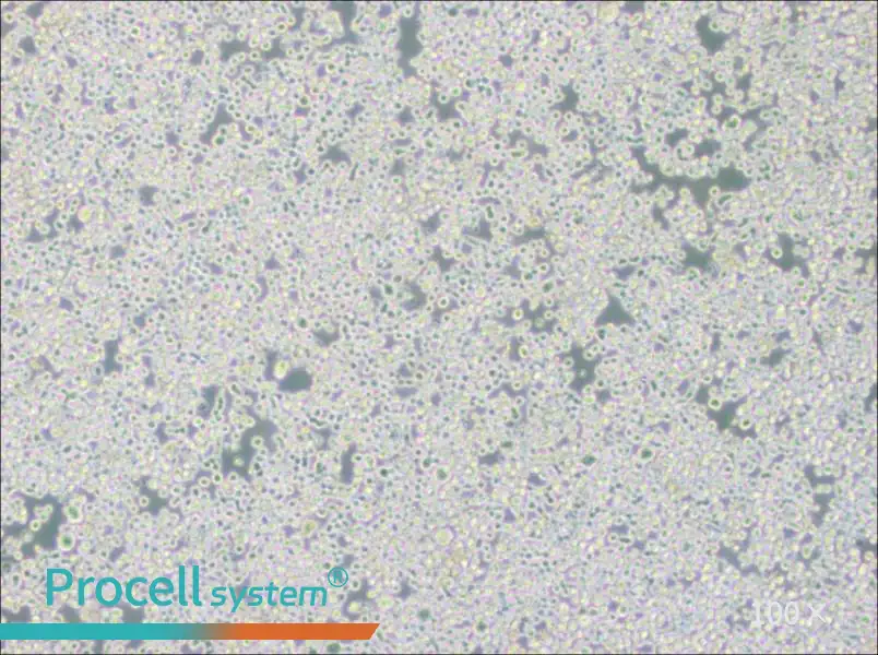 RPMI 8226 Cell Complete Medium - 2