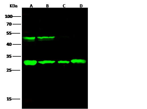 Recombinant Cathepsin D/CTSD Monoclonal Antibody - small - 3