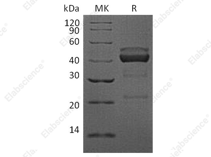 Recombinant Human TIGIT Protein (mFc Tag) - 1