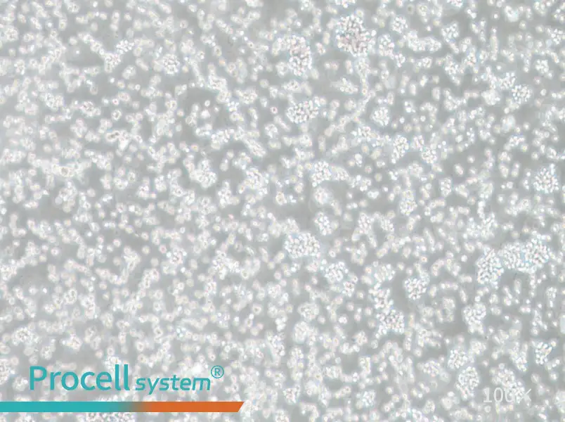 SU-DHL-6 Cell Complete MediumSU-DHL-6 Cell Complete Medium - 2