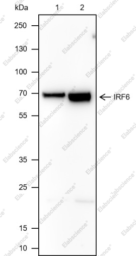 Recombinant IRF6 Monoclonal Antibody - 1