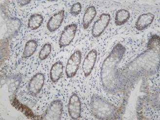 Recombinant Claudin 4 Monoclonal Antibody - 1