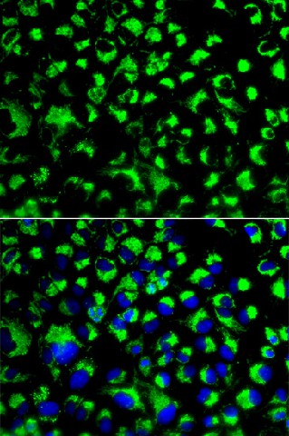 Immunofluorescence analysis of U2OS cells using HSPA9 Polyclonal Antibody