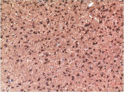 Immunohistochemistry of paraffin-embedded Rat brain tissue using Tau Polyclonal Antibody at dilution of 1:200.