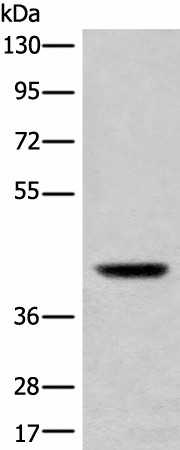 Western blot analysis of Mouse liver tissue lysate  using USP12 Polyclonal Antibody at dilution of 1:700