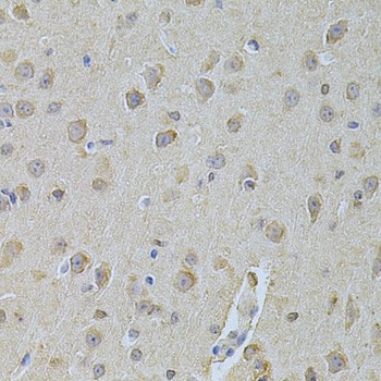 Immunohistochemistry of paraffin-embedded Mouse brain using NME1 Polyclonal Antibody at dilution of 1:200 (40x lens).