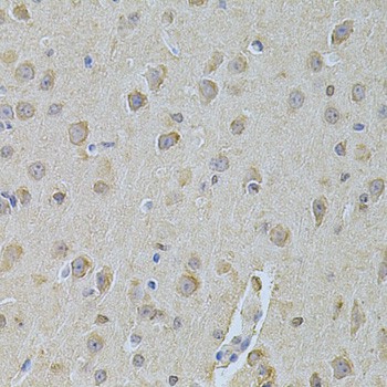 Immunohistochemistry of paraffin-embedded Mouse brain using NME1 Polyclonal Antibody at dilution of  1:200 (40x lens).