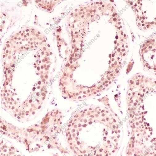 Recombinant SF1 Monoclonal Antibody - 2