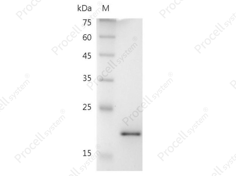 TRAIL/TNFSF10/TL2/Apo2L/CD253, Mouse, Recombinant