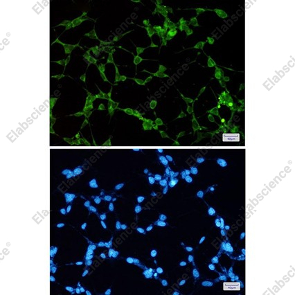 Recombinant ORP1 Monoclonal Antibody - 3