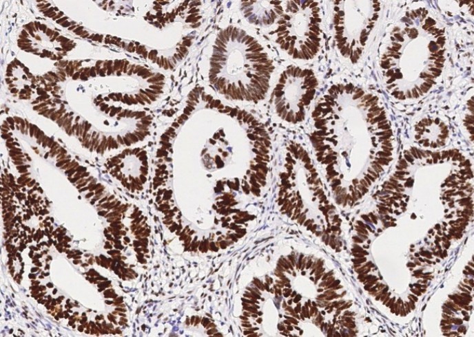 Recombinant MSH6/GTBP Monoclonal Antibody - small - 3