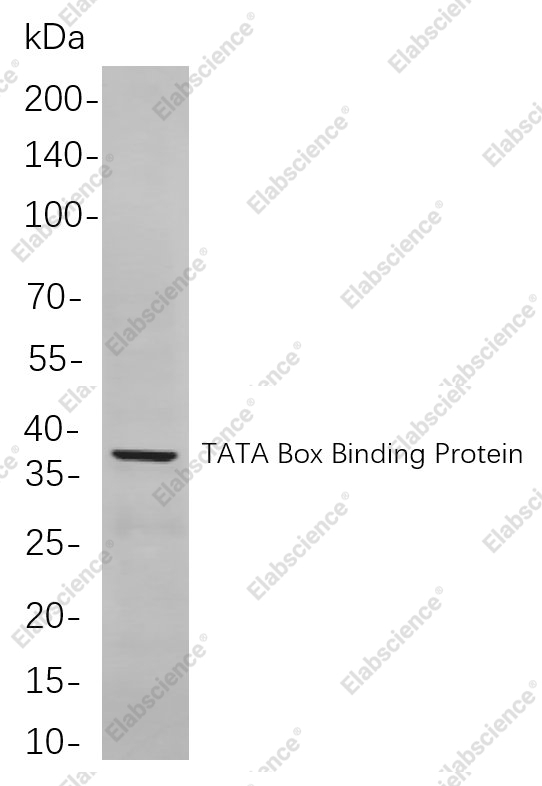 Recombinant TATA Box Binding Protein Monoclonal Antibody - 1