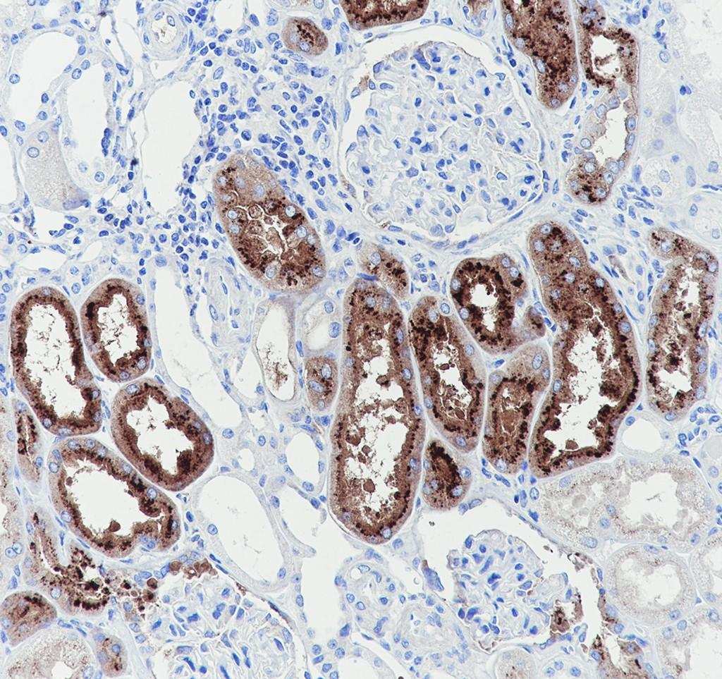 Recombinant Prealbumin/Transthyretin Monoclonal Antibody-searchlist-3