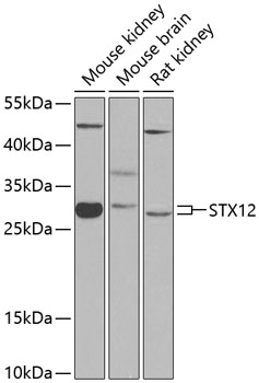 Western blot analysis of extracts of various cell lines using STX12 Polyclonal Antibody at 1:1000 dilution.