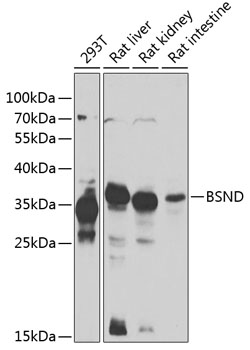 Western blot analysis of extracts of various cell lines using BSND Polyclonal Antibody at 1:1000 dilution.