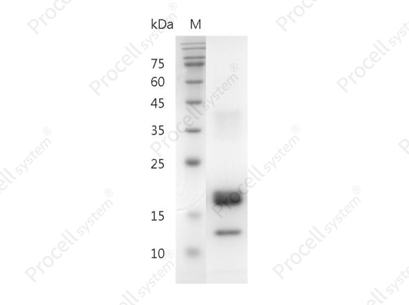 M-CSF/CSF-1/MGI-IM, Human, Recombinant