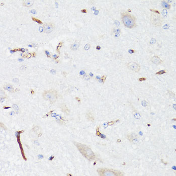 Immunohistochemistry of paraffin-embedded Mouse spinal cord endothelial cells using EGFR Polyclonal Antibody at dilution of 1:150 (40x lens).