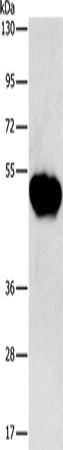 Western Blot analysis of Human fetal brain tissue using CHRDL2 Polyclonal Antibody at dilution of 1:600