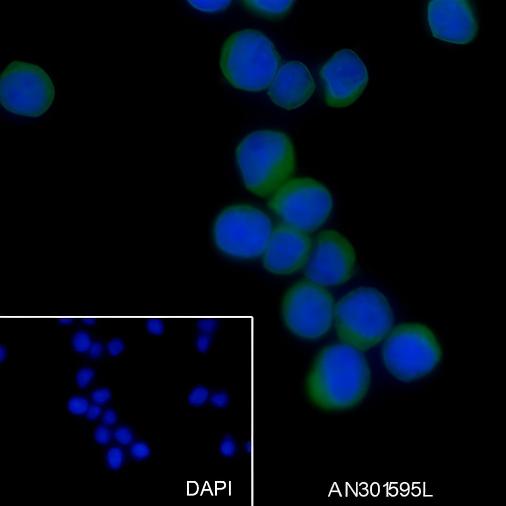 Recombinant MALT1/MLT Monoclonal Antibody - 3