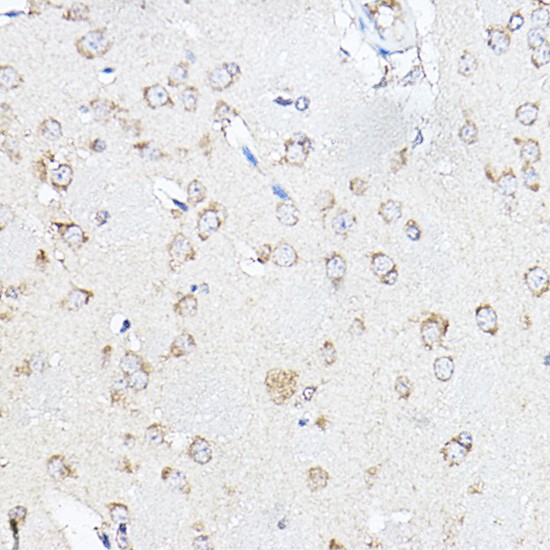(KO Validated) SCD Polyclonal Antibody - small - 4