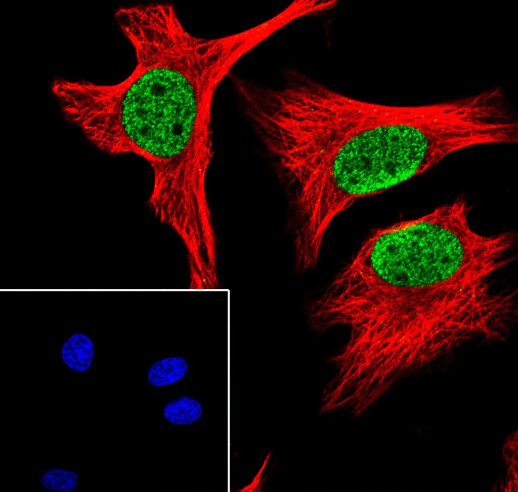 Recombinant Hisotne H3 (Mono Methyl Lys27) Monoclonal Antibody - small - 5