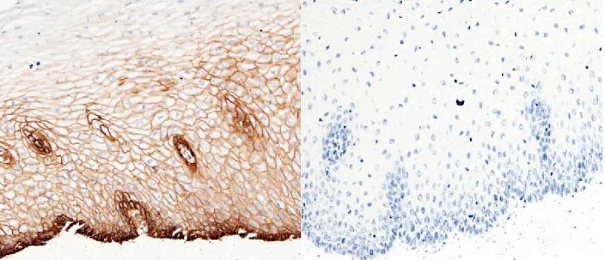 Recombinant CD147/EMMPRIN/Basigin Monoclonal Antibody - small - 9