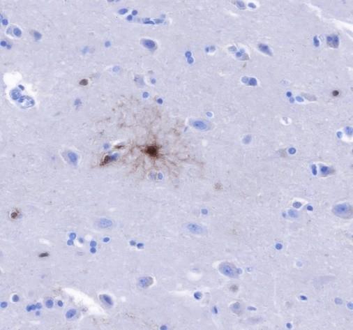 Recombinant FABP7 Monoclonal Antibody-searchlist-2