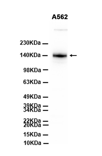 Recombinant TrkA/NTRK1 Monoclonal Antibody - 2