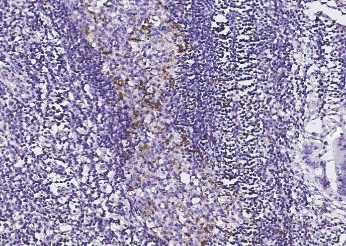 Recombinant PD1/PDCD1/CD279 Monoclonal Antibody - small - 3