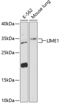 Western blot analysis of extracts of various cell lines using LIME1 Polyclonal Antibody at 1:3000 dilution.