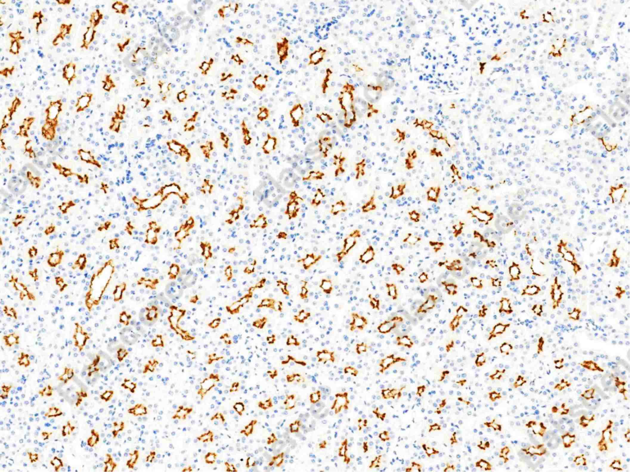 Recombinant Syndecan-1/SDC1 Monoclonal Antibody - 2