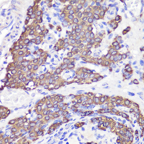 Immunohistochemistry of paraffin-embedded rat testis using UBL3 Polyclonal Antibody at dilution of 1:100 (40x lens).Perform microwave antigen retrieval with 10 mM PBS buffer pH 7.2 before commencing with IHC staining protocol.