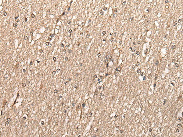 Immunohistochemistry of paraffin-embedded Human brain tissue  using PCNA Polyclonal Antibody at dilution of 1:35(?200)