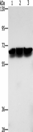 Western blot analysis of Jurkat cells hela cells mouse brain tissue  using ZBTB1  Polyclonal Antibody at dilution of 1:500