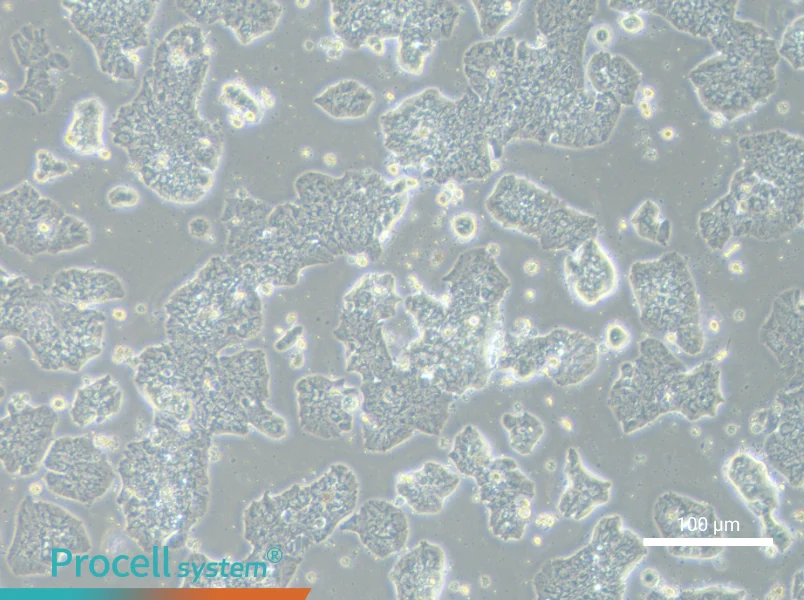 HCC1500 Cell Complete MediumHCC1500 Cell Complete Medium - 1