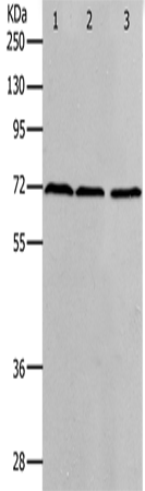 Western Blot analysis of K562, hela and 293T cell using PRMT5 Polyclonal Antibody at dilution of 1:400